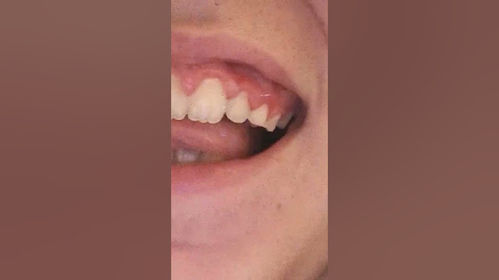 ENFIN J'AI ENLEVÉ MES BAGUE