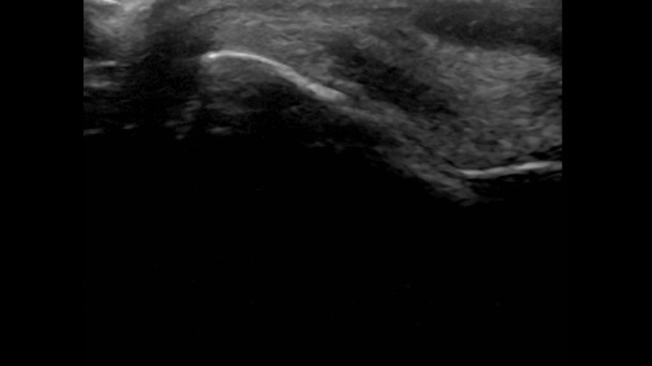 Fetlock ultrasound flexed transverse