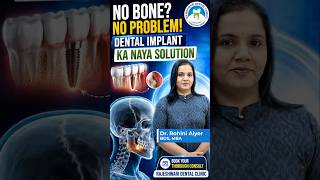 Bone Nahi Hai? Fir Bhi Dental Implant Ho Sakta Hai! 🦷