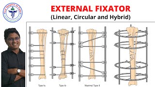 External Fixator | Lecture 07 | Orthopedics