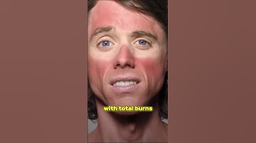 What If Oxygen Disappeared on Earth for 5 Seconds? #whatif #oxygen #shorts