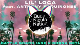 Lil Loca Feat Anthony B Quiones  Battle Scars all U Gonna Get Bass Boosted