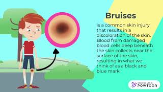 Common Medical Injuries and First Aid Treatments