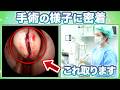 【手術に密着】悪臭の原因は歯が原因?!...副鼻腔炎手術の裏側に迫る【歯性上顎洞炎】