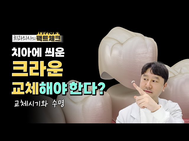 크라운은 언제 교체해야 할까요? | 크라운 재치료🦷