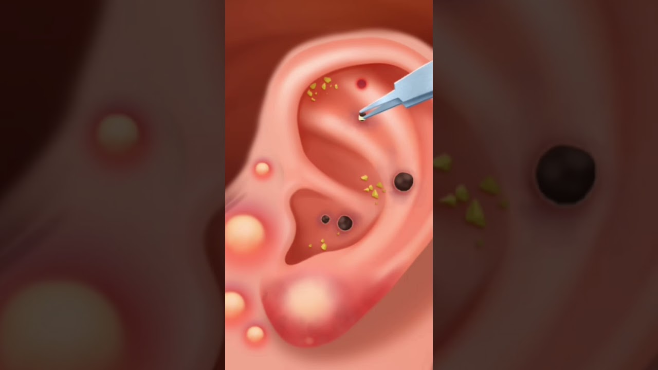 Happy Hospital: Doctor ASMR Game 1