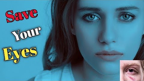 Best Rules to Save Eyes From Mobile and Computer Screen 🔥🔥