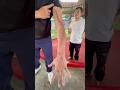 He Survived Multiple Bites from a Cobra! #shorts #kingcobra #snake #bite #phuket #ahas
