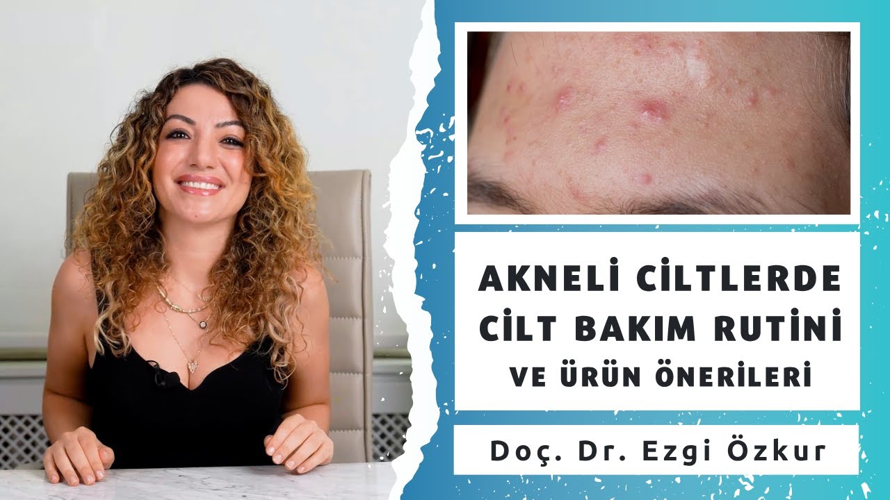 Sivilceli Ciltlerde Cilt Bakım Rutini ve Ürün Önerileri
