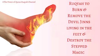 Ultimate Ruqyah to burn \u0026 remove Devil Jinns living in the legs \u0026 feet \u0026 Destroy the Stepped Magic