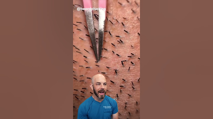 This hair plucking is an interesting hobby 🫢 (credit: @beardplucking on TT)#doctor #satisfying