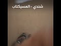 شندي المسيكتاب تنتفض تسقط بس