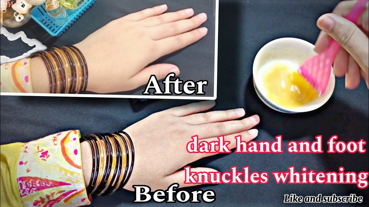 Dark Hand And Foot Knuckles Whitening how to lighten your dark handsand feetskincare YouTube