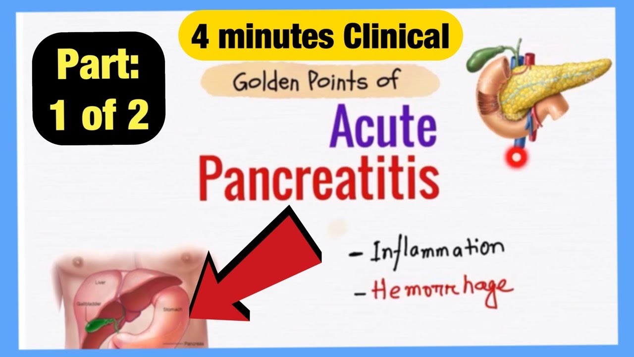 Acute Pancreatitis Explained Like Water Part 1 Symptoms Pathogenesis