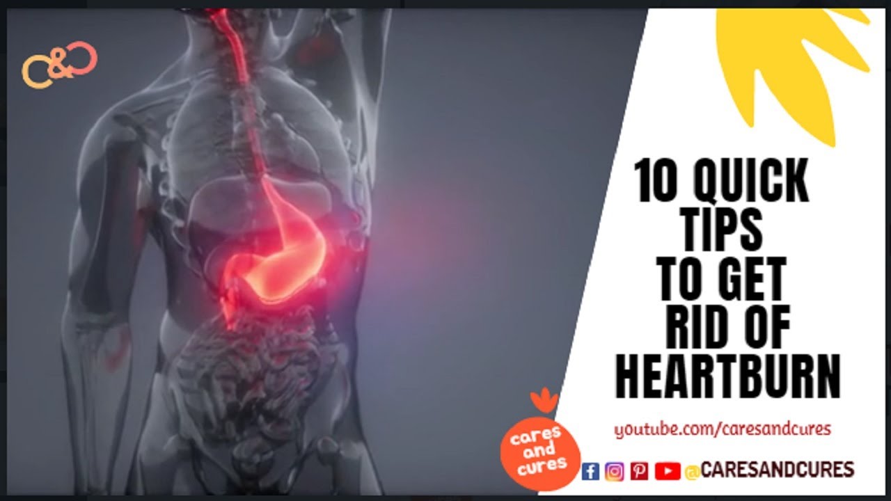 How To Get Rid Of Acid Reflux In Throat Fast Acid Reflux Symptoms how-to-get-rid-of-acid-reflux-in-throat-fast-acid-reflux-symptoms