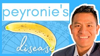 How to Straighten Out a Bent Penis with Peyronie's Disease
