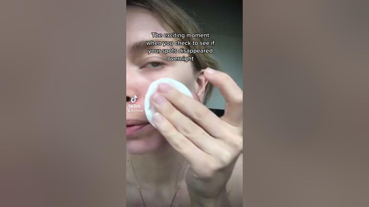 zinc-oxide-will-remove-your-spots-overnight-youtube