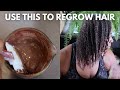Reduce Scalp Inflammation and Block DHT| Prevent Hair Loss Challenge-Week 9