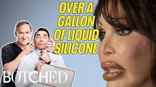 Botched Patients HAUNTED by Past Procedures: Shaved Cheek Bones & Migrating Silicone | Botched | E!