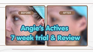 WATCH BEFORE YOU BUY  // Angie’s actives Skincare Review