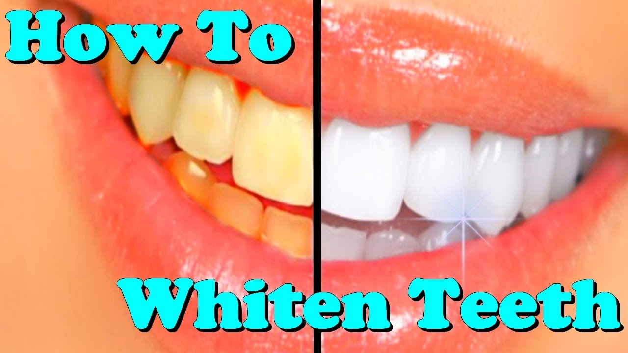 how to whiten teeth YouTube
