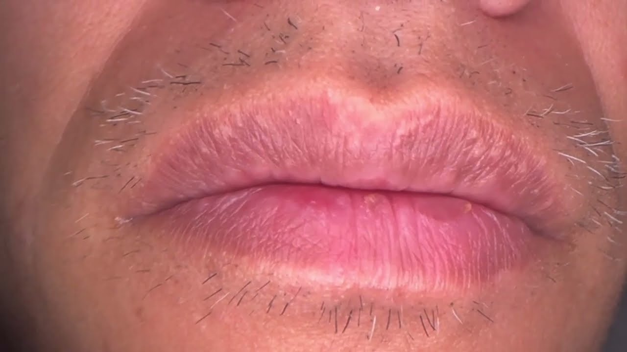 Very satisfying plucking beard experience