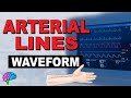 Arterial Pressure Tracing Quiz