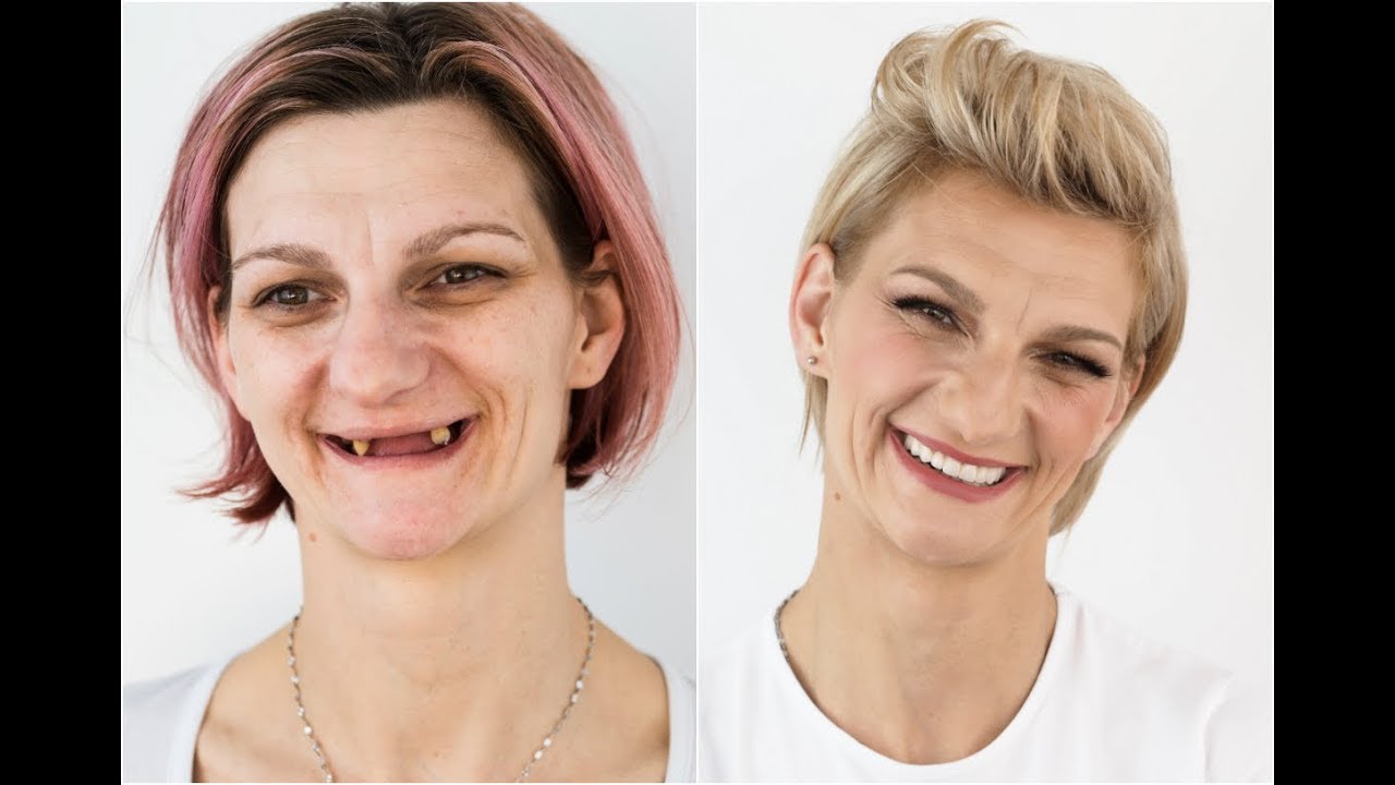 Humanitarni makeover 2017 ŠTIMAC CENTRA DENTALNE MEDICINE u InMagazinu - Anita