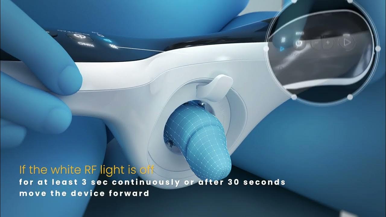 How to treat with Vertica (Erectile Dysfunction or Impotency) YouTube