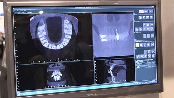 Top Features of the J. Morita Veraviewepocs 3D R100