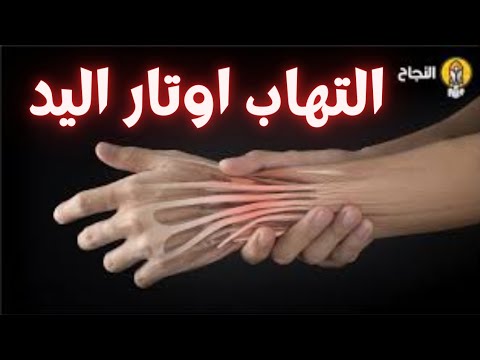 التهاب اوتار اليد أسباب وعلاج التهاب اوتار اليد التهاب اوتار اليد وعلاجها التهاب اوتار اليدين
