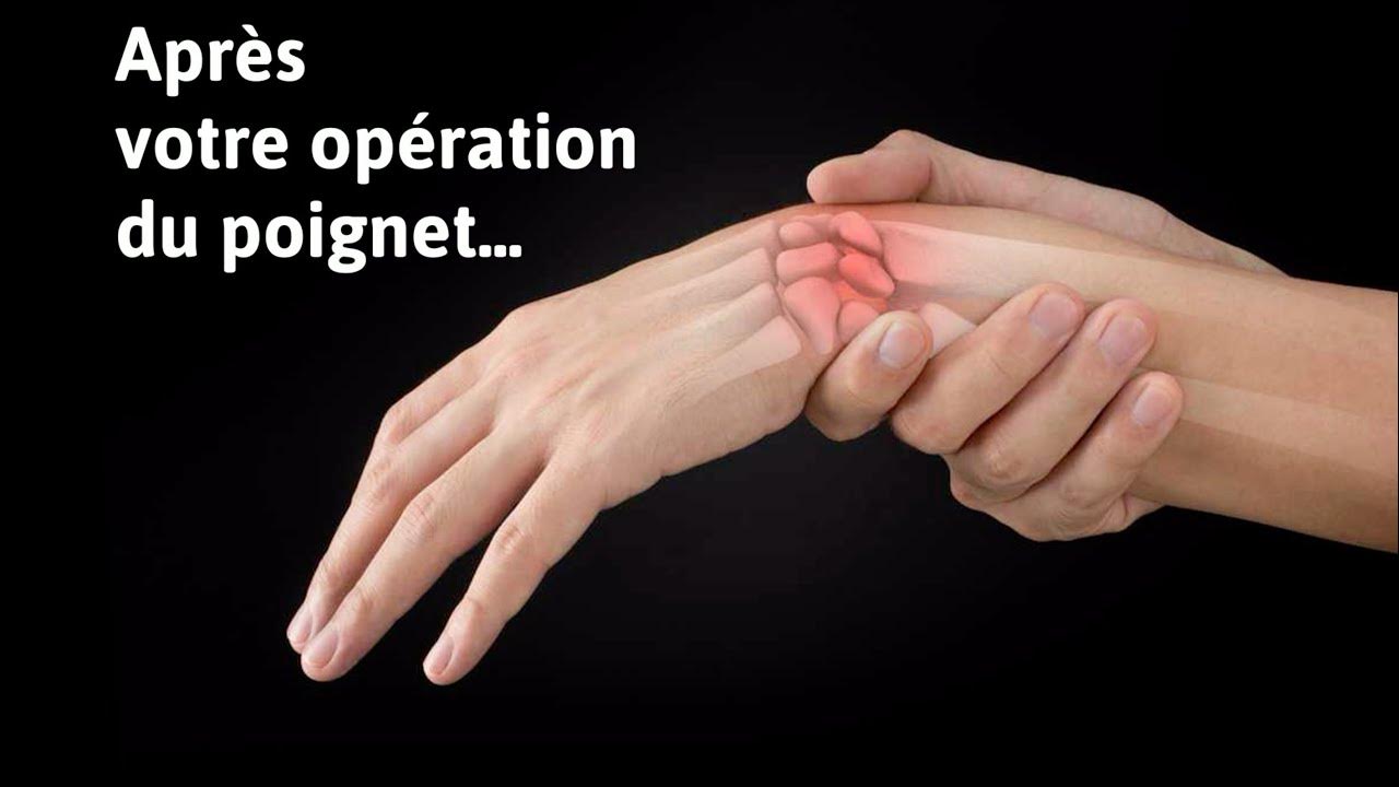 Conseils après votre opération du YouTube