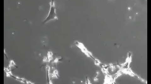 Brain cells in a culture dish trying to form connections with each other