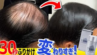 【薄毛対策】話題の”アレ”で増毛してみた！【スーパーミリオンヘアー】