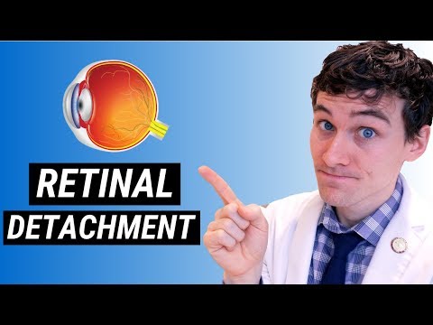 Video: Waar kom losstaande retina voor?