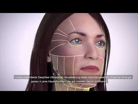 Ultherapy: "Gold Standard" für Lifting ganz ohne Operation 2 Ultherapy: LIFTING ohne OP bei OmniMed Eisenstadt, Klagenfurt und Linz