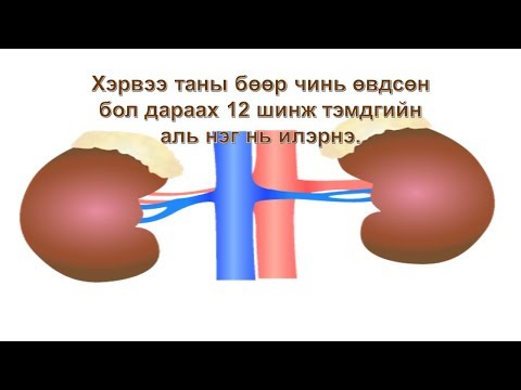 Видео: Гидронефроз нь бөөрний архаг өвчин мөн үү?