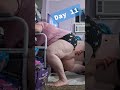 day 11 trying to get up from my right leg