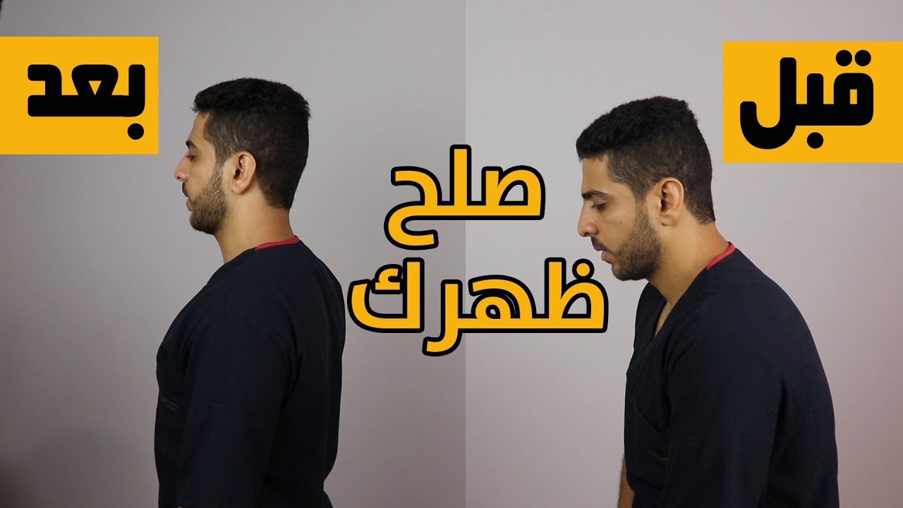 اهم التمارين لعلاج تقوس الظهر (علاج الاتب)فى 2020/ودع الاتب نهائيا ...