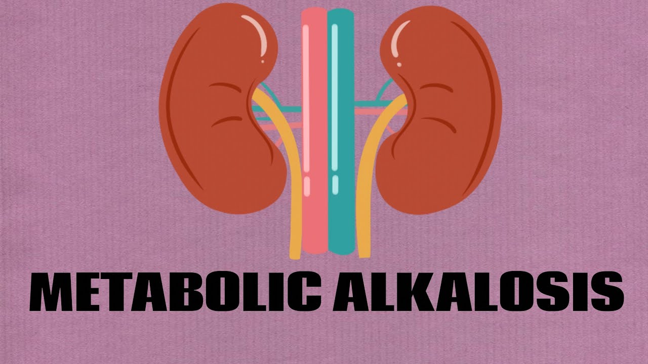 Metabolic alkalosis || Hypokalemia