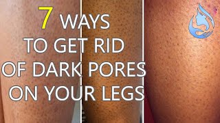 7 Ways to Get Rid of Dark Pores On Your Legs