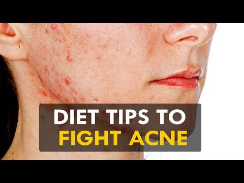 Diet Tips to Fight Acne - Health Sutra