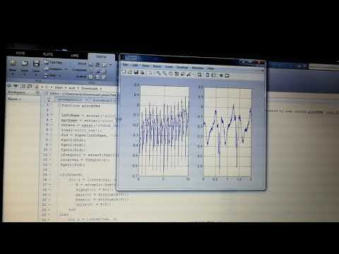 EEG signals running
