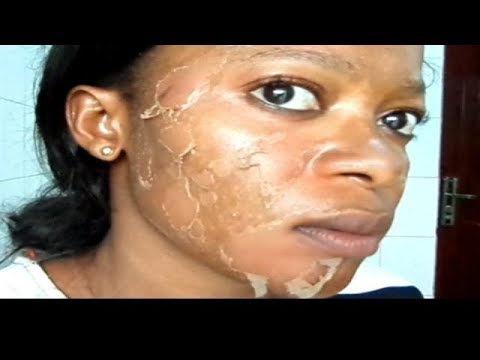 Skin Face