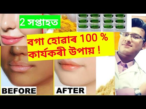 Beauty tips Assamese | health tips Assamese |  how to fair  naturally in assamese | assamese health