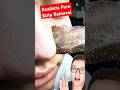 Realistic PORE STRIP REMOVAL #shorts