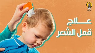 8 علاجات سريعة للتخلص من قمل الشعر عند الأطفال