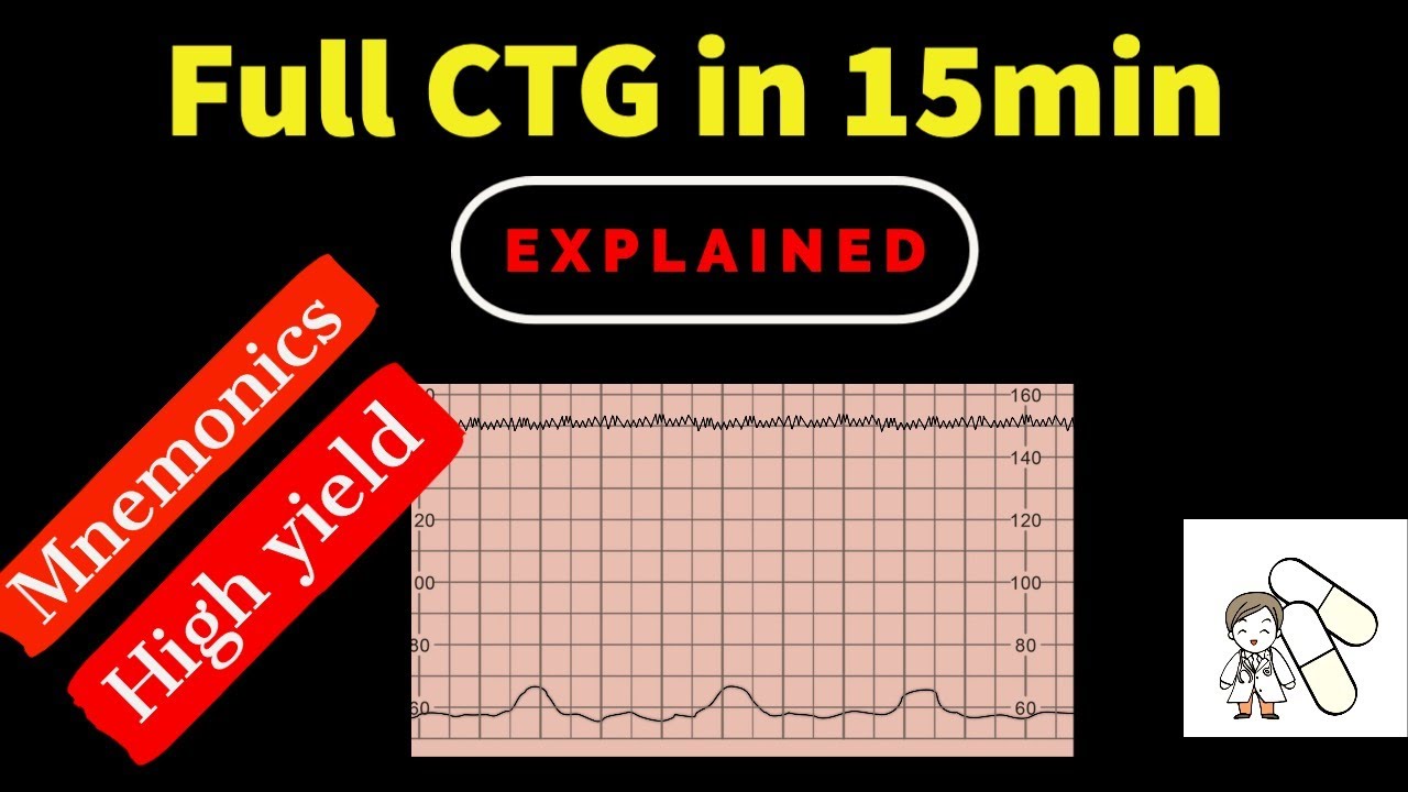 OB&G Crash course - #13 Full CTG in 15 minuets -  With handout