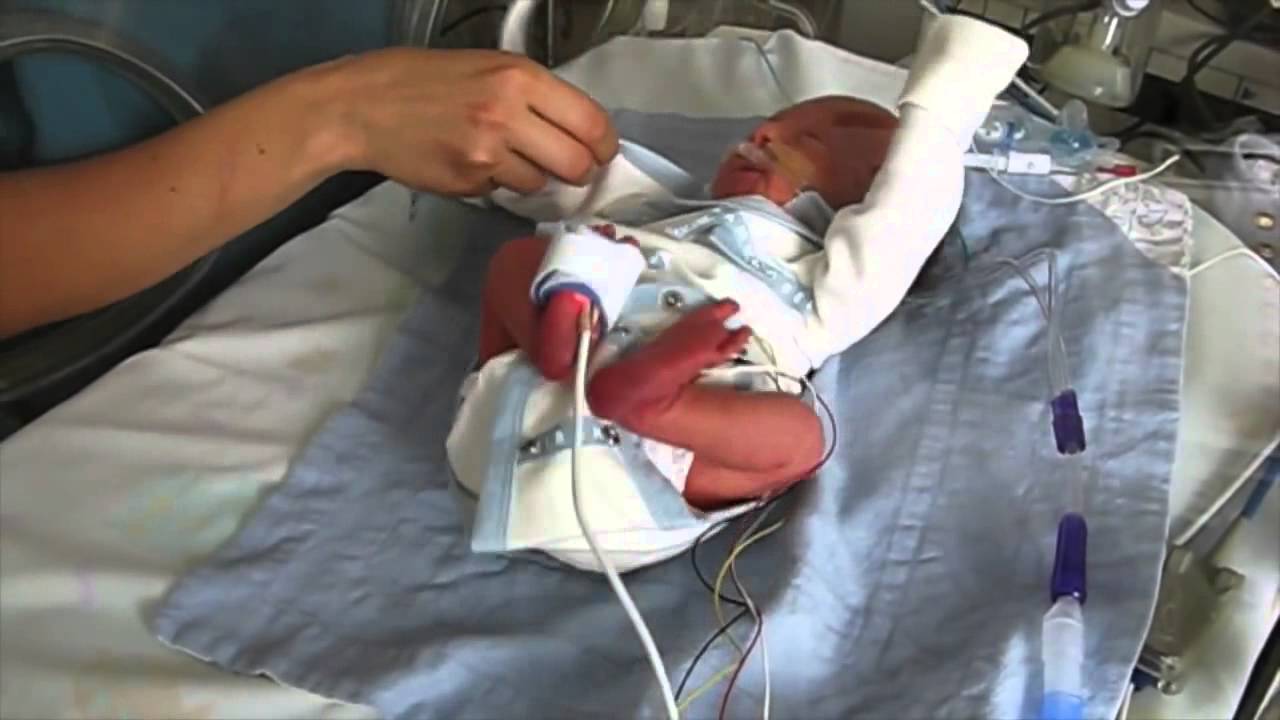 How to dress a newborn preemie baby? by YouTube
