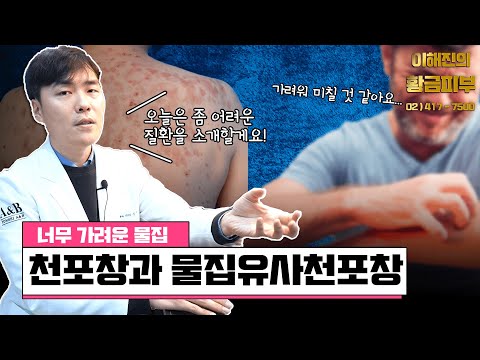 난치성 피부질환 천포창 - 검증되지 않은 치료법은 피하셔야 합니다 / 연세에이앤비 피부과 이해진원장